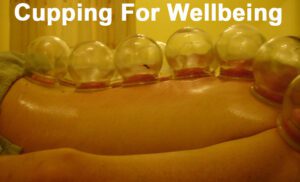 Read more about the article Cupping for Wellbeing